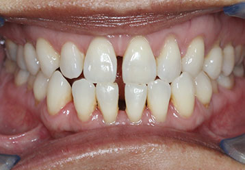 before-agnes-orthodontics