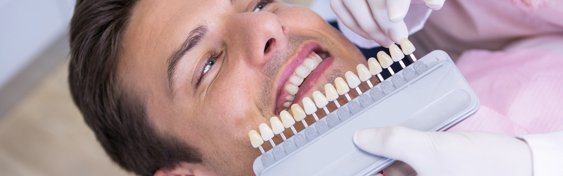 Comoposite Veneers